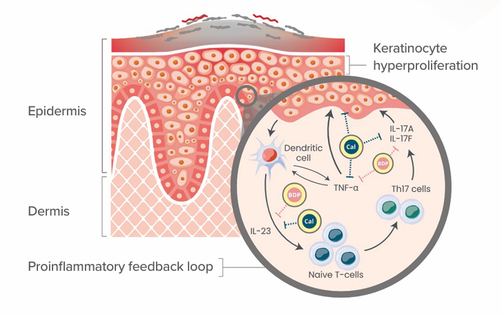 Inflammatory pathway mechanism diagram